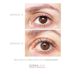 Serum Crecimiento De Pestañas Supralash Suero Belleza 2.9ml