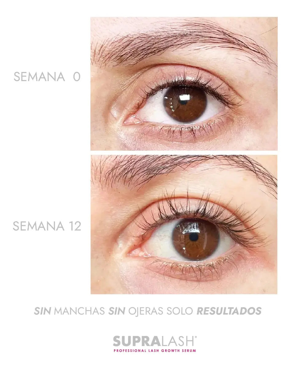 Serum para crecimiento de pestañas 2.9 ml SUPRALASH