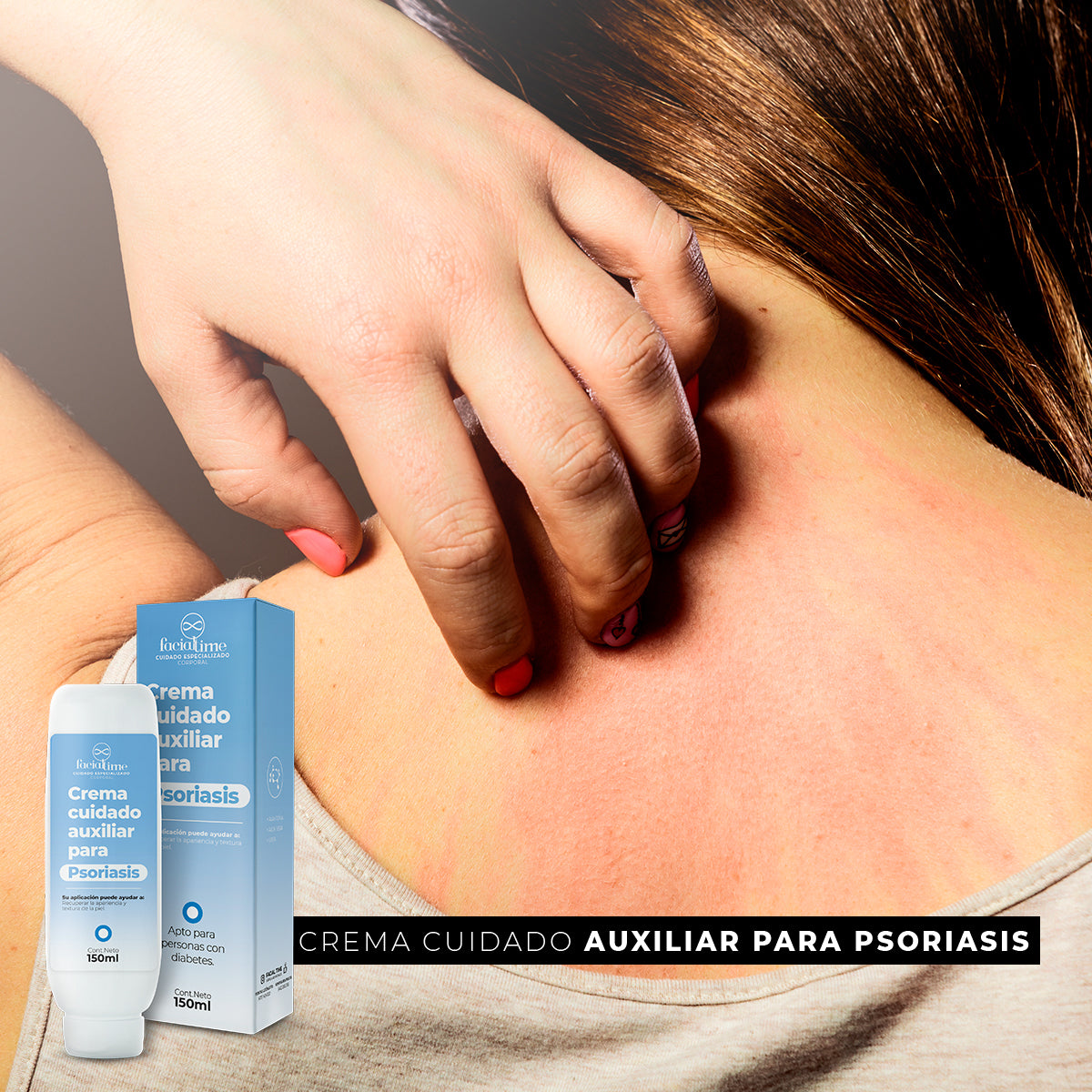 Crema hidratante urea aloe vitamina A psoriasis FacialTime