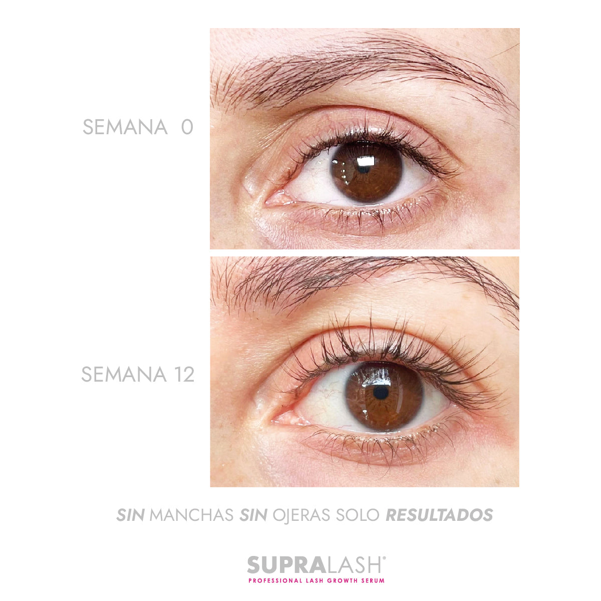 Serum para crecimiento de pestañas 2.9 ml SUPRALASH